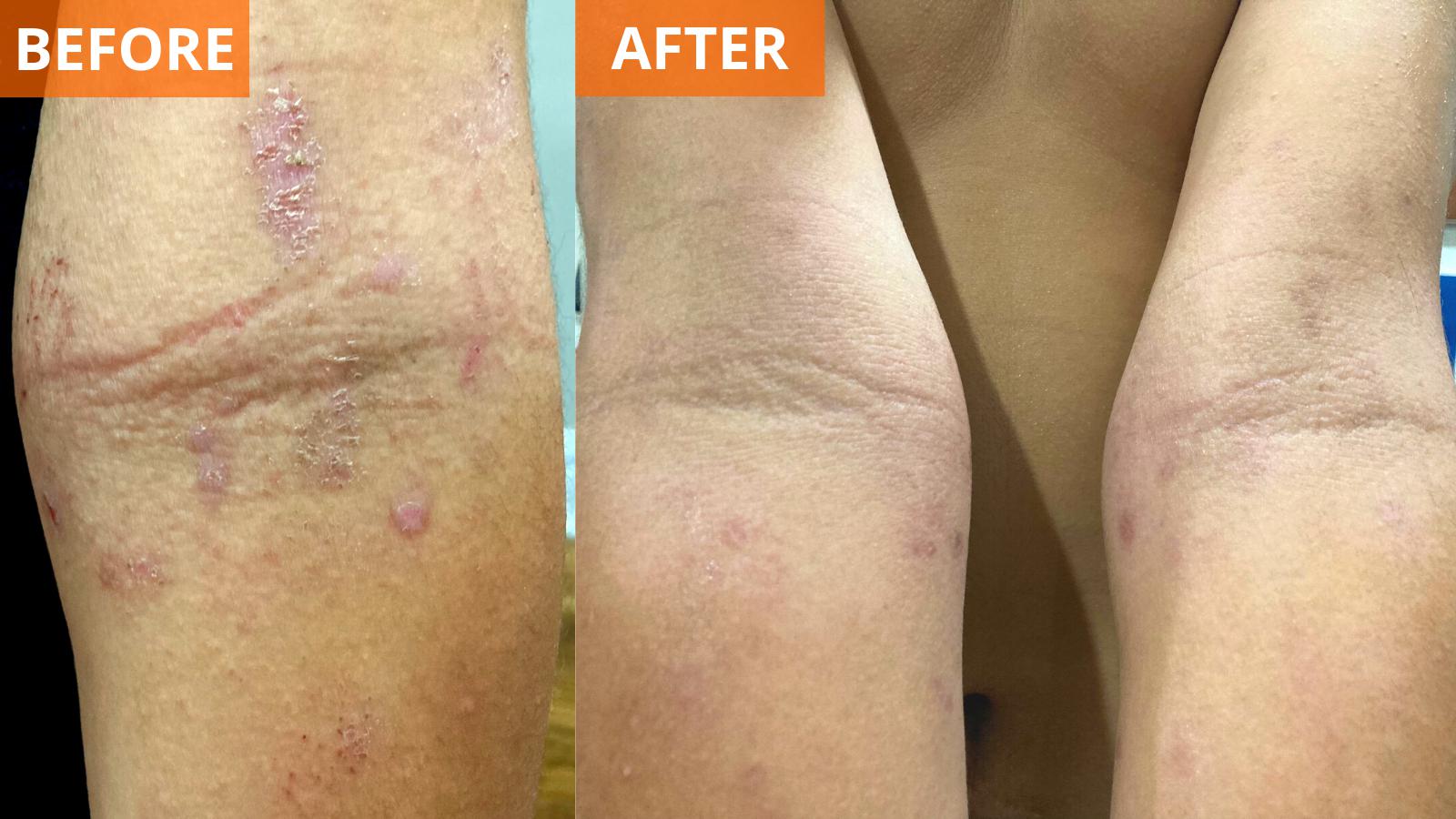 Yu-Be Moisturizing Skin Cream