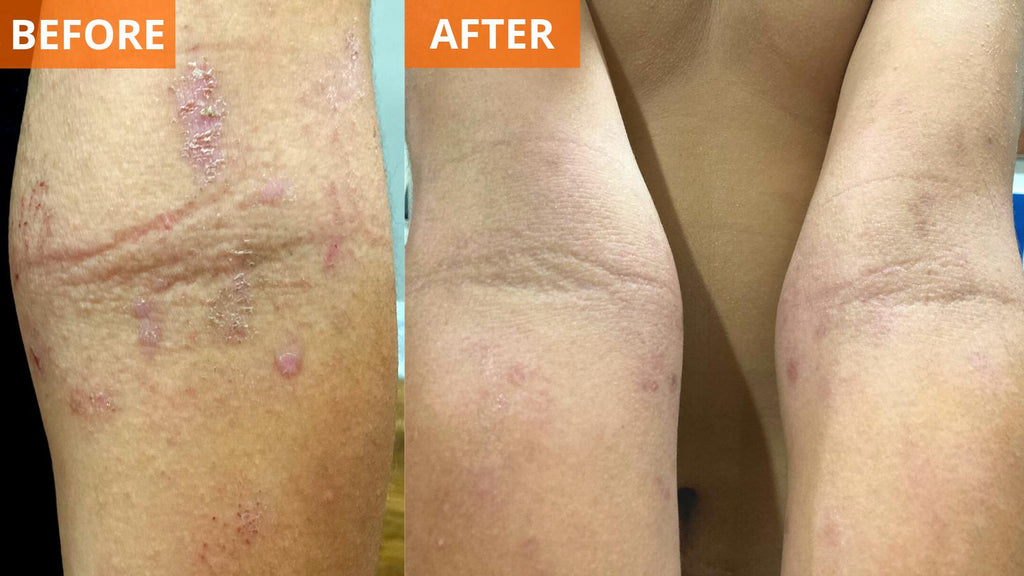 Yu-Be Moisturizing Skin Cream